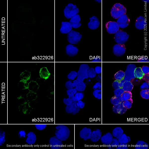 Immunocytochemistry/ Immunofluorescence - Anti-Interferon gamma antibody [RM1245] (AB322926)