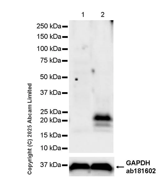 Western blot - Anti-Interferon gamma antibody [RM1245] (AB322926)