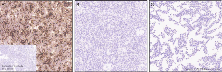 Immunohistochemistry (Formalin/PFA-fixed paraffin-embedded sections) - Anti-Interferon lambda-2 antibody [EPR30981-15] (AB326933)