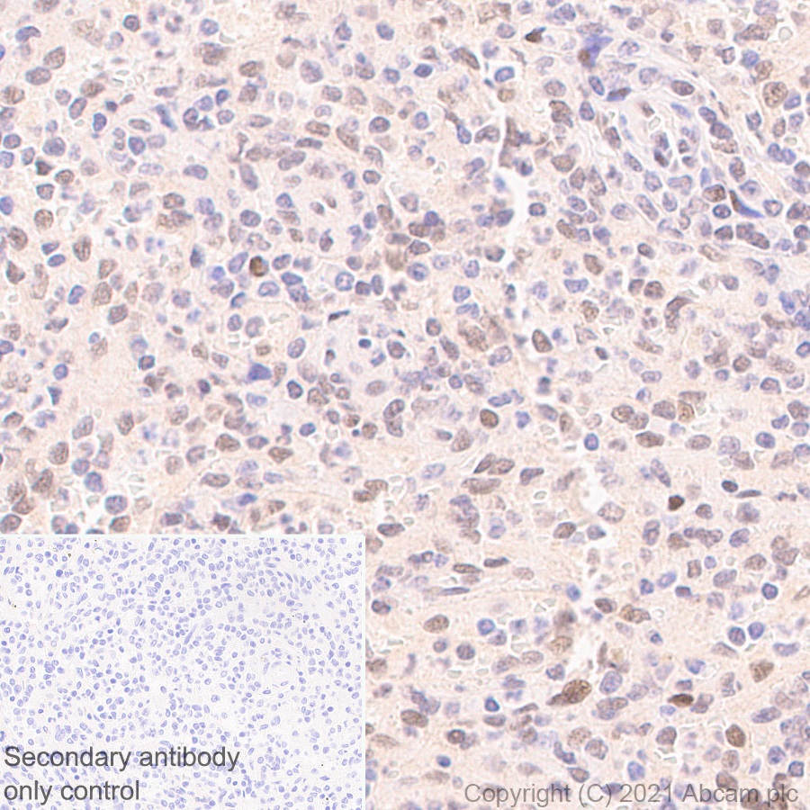Immunohistochemistry (Formalin/PFA-fixed paraffin-embedded sections) - Anti-Interferon regulatory factor 9/IRF-9 antibody [EPR24260-55] (ab271043), expandable thumbnail