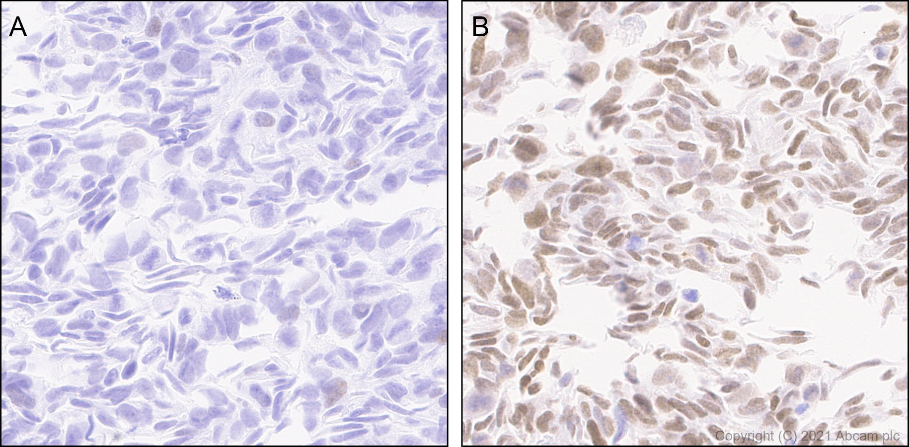 Immunohistochemistry (Formalin/PFA-fixed paraffin-embedded sections) - Anti-Interferon regulatory factor 9/IRF-9 antibody [EPR24260-55] (ab271043), expandable thumbnail