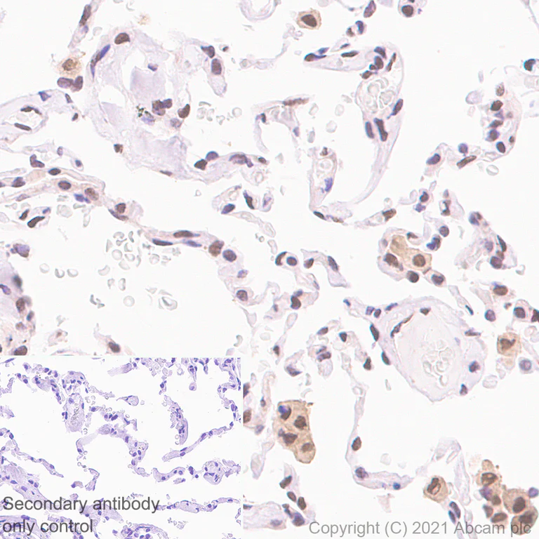 Immunohistochemistry (Formalin/PFA-fixed paraffin-embedded sections) - Anti-Interferon regulatory factor 9/IRF-9 antibody [EPR24260-55] (AB271043)