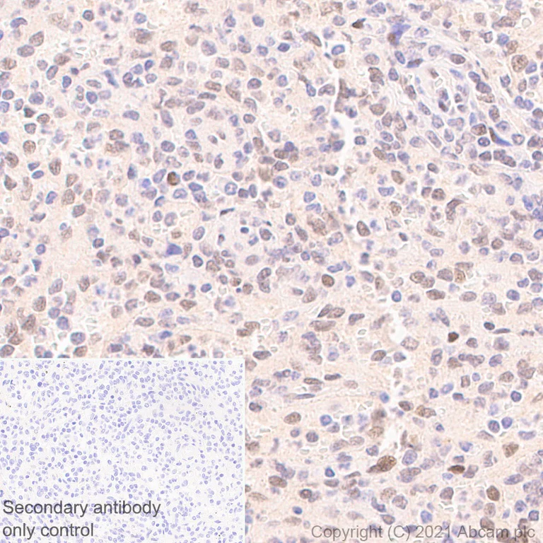 Immunohistochemistry (Formalin/PFA-fixed paraffin-embedded sections) - Anti-Interferon regulatory factor 9/IRF-9 antibody [EPR24260-55] - BSA and Azide free (AB282125)
