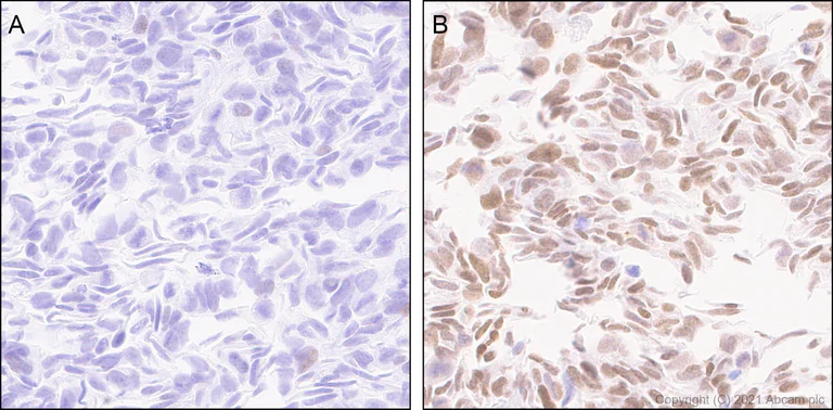 Immunohistochemistry (Formalin/PFA-fixed paraffin-embedded sections) - Anti-Interferon regulatory factor 9/IRF-9 antibody [EPR24260-55] - BSA and Azide free (AB282125)