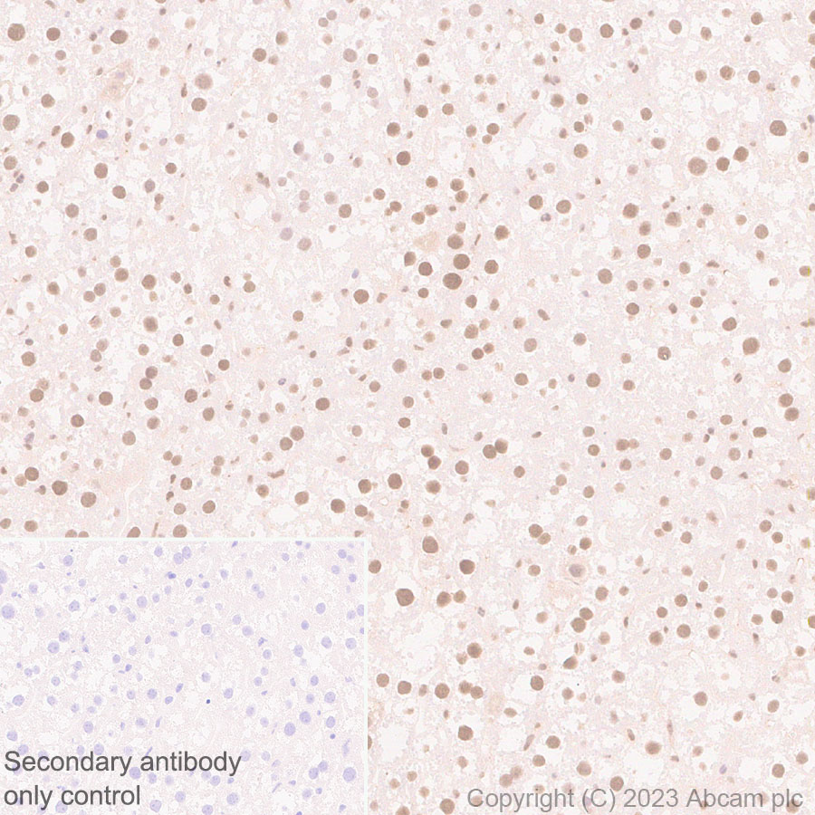 Immunohistochemistry (Formalin/PFA-fixed paraffin-embedded sections) - Anti-Interferon regulatory factor 9/IRF-9 antibody [EPR27554-69] (ab315277), expandable thumbnail