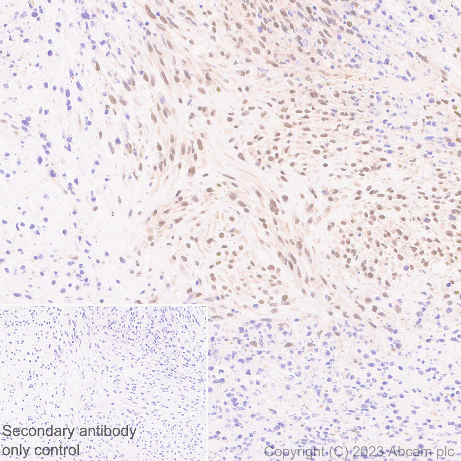 Immunohistochemistry (Formalin/PFA-fixed paraffin-embedded sections) - Anti-Interferon regulatory factor 9/IRF-9 antibody [EPR27554-69] (ab315277), expandable thumbnail