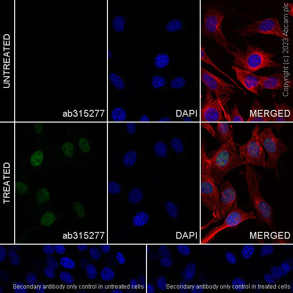 Immunocytochemistry/ Immunofluorescence - Anti-Interferon regulatory factor 9/IRF-9 antibody [EPR27554-69] - BSA and Azide free (AB315278)