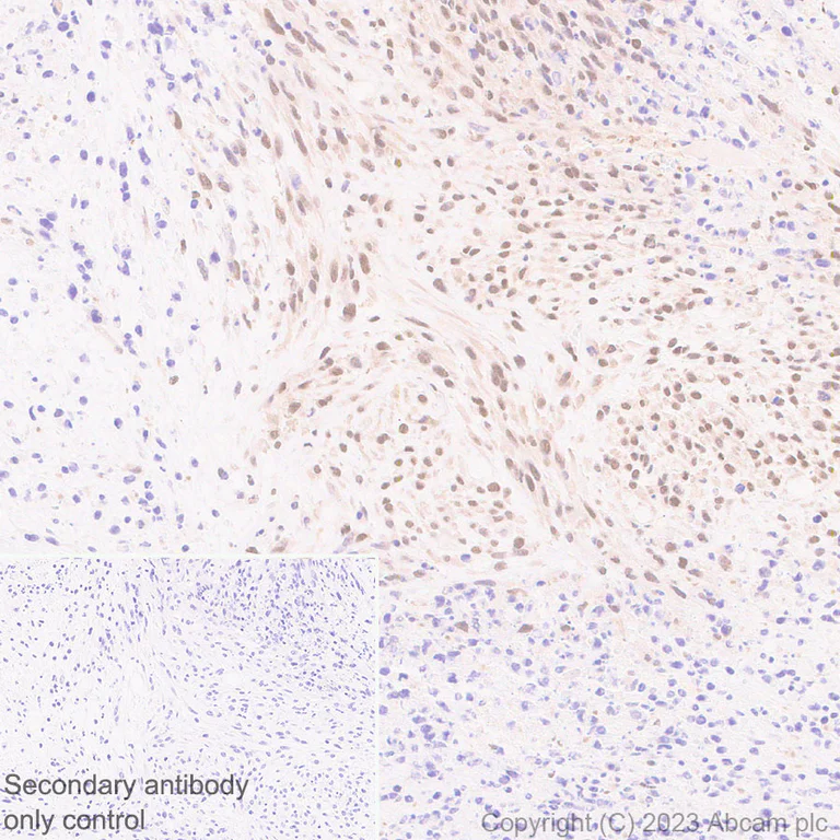 Immunohistochemistry (Formalin/PFA-fixed paraffin-embedded sections) - Anti-Interferon regulatory factor 9/IRF-9 antibody [EPR27554-69] - BSA and Azide free (AB315278)