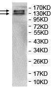 Western blot - Anti-Intersectin 1 antibody (AB118262)