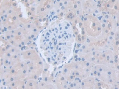 Immunohistochemistry (Formalin/PFA-fixed paraffin-embedded sections) - Anti-Intersectin 1 antibody (AB231338)