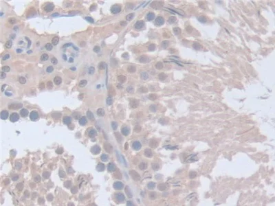 Immunohistochemistry (Formalin/PFA-fixed paraffin-embedded sections) - Anti-Intersectin 1 antibody (AB231338)