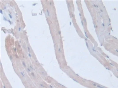 Immunohistochemistry (Formalin/PFA-fixed paraffin-embedded sections) - Anti-Intersectin 1 antibody (AB231338)