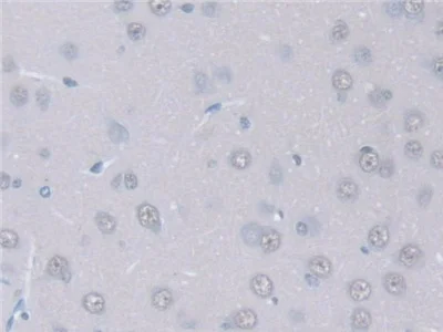 Immunohistochemistry (Formalin/PFA-fixed paraffin-embedded sections) - Anti-Intersectin 1 antibody (AB231338)