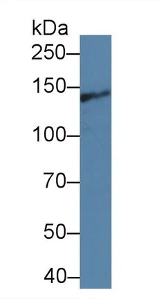 Western blot - Anti-Intersectin 1 antibody (AB231338)