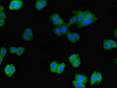 Immunocytochemistry/ Immunofluorescence - Anti-Intersectin-2 antibody (AB237509)