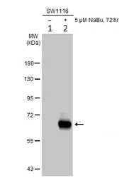 Western blot - Anti-intestinal alkaline phosphatase antibody (AB97532)