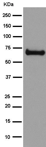Western blot - Anti-intestinal alkaline phosphatase antibody [EPR15201(B)] (AB186422)