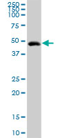 Western blot - Anti-Intrinsic Factor antibody (AB102049)