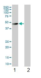 Western blot - Anti-Intrinsic Factor antibody (AB102049)