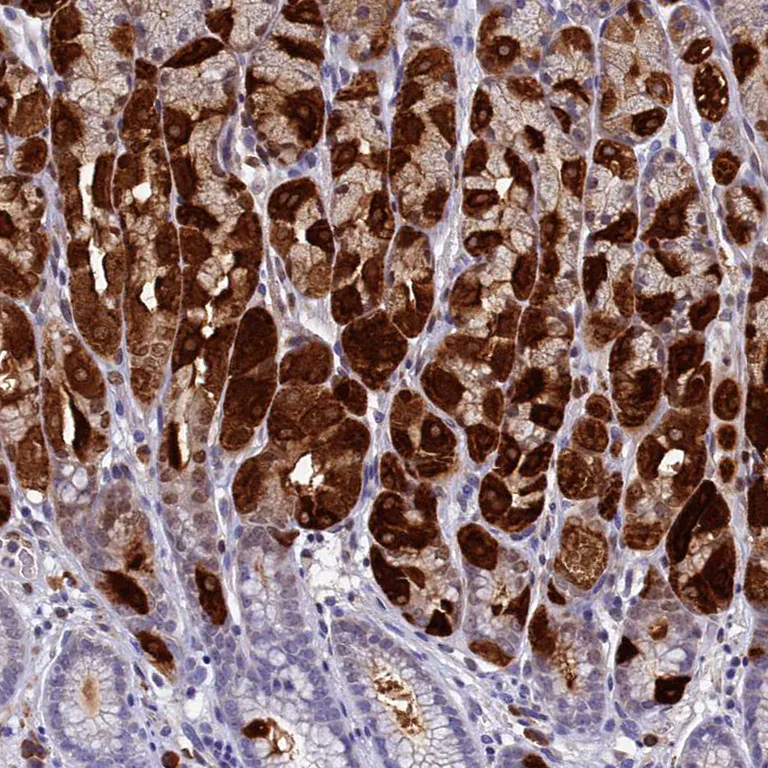 Immunohistochemistry (Formalin/PFA-fixed paraffin-embedded sections) - Anti-Intrinsic Factor antibody (AB262912)