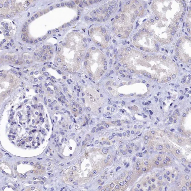 Immunohistochemistry (Formalin/PFA-fixed paraffin-embedded sections) - Anti-Intrinsic Factor antibody (AB262912)