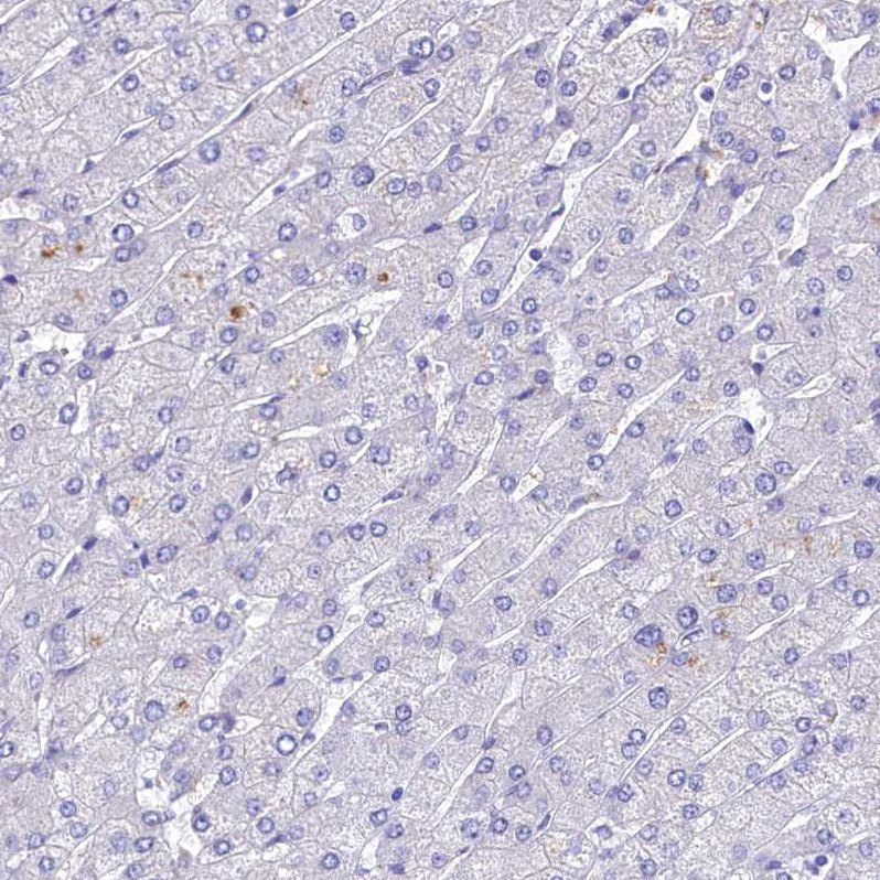 Immunohistochemistry (Formalin/PFA-fixed paraffin-embedded sections) - Anti-Intrinsic Factor antibody (AB262912)