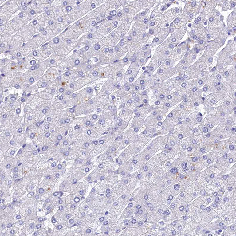 Immunohistochemistry (Formalin/PFA-fixed paraffin-embedded sections) - Anti-Intrinsic Factor antibody (AB262912)