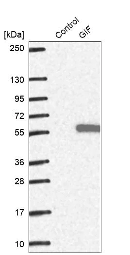 Western blot - Anti-Intrinsic Factor antibody (AB262912)