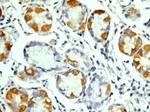 Immunohistochemistry (Formalin/PFA-fixed paraffin-embedded sections) - Anti-Intrinsic Factor antibody [EPR13488(B)] (AB181045)