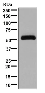 Western blot - Anti-Intrinsic Factor antibody [EPR13488(B)] - BSA and Azide free (AB221500)