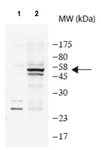 Western blot - Anti-Intron-encoded endonuclease I-SceI antibody (AB216263), expandable thumbnail