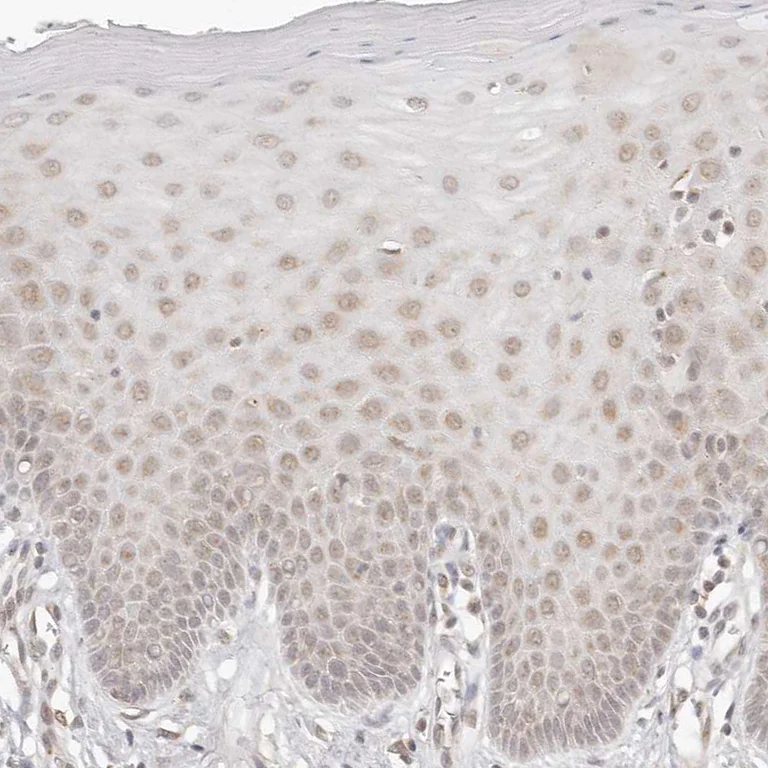 Immunohistochemistry (Formalin/PFA-fixed paraffin-embedded sections) - Anti-INTS11 antibody (AB224765)