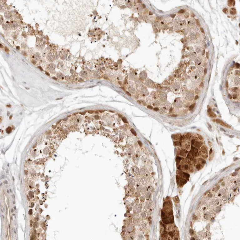 Immunohistochemistry (Formalin/PFA-fixed paraffin-embedded sections) - Anti-INTS11 antibody (AB224765)
