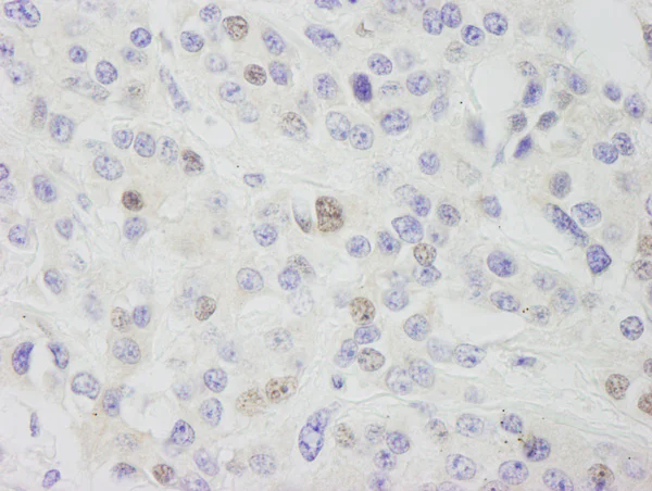 Immunohistochemistry (Formalin/PFA-fixed paraffin-embedded sections) - Anti-INTS11 antibody (AB75276)