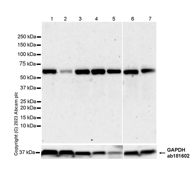 Western blot - Anti-INTS11 antibody [EPR28317-52-] - BSA and Azide free (AB315167)
