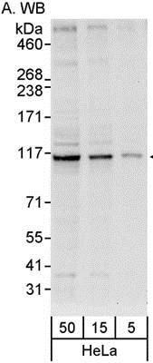 Western blot - Anti-INTS6 antibody (AB86369)