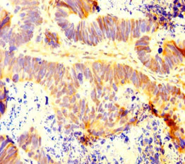Immunohistochemistry (Formalin/PFA-fixed paraffin-embedded sections) - Anti-INTS9 antibody (AB234700)