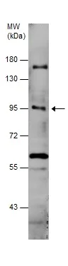 Western blot - Anti-INTU antibody - C-terminal (AB229243)