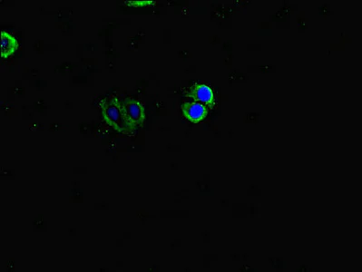 Immunocytochemistry/ Immunofluorescence - Anti-Inversin antibody (AB234853)