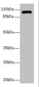 Western blot - Anti-Inversin antibody (AB234853)