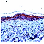 Immunohistochemistry (Formalin/PFA-fixed paraffin-embedded sections) - Anti-Involucrin antibody (AB27495), expandable thumbnail