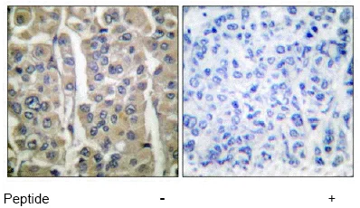 Immunohistochemistry (Formalin/PFA-fixed paraffin-embedded sections) - Anti-Involucrin antibody (AB53112)