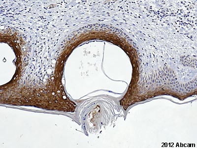 Immunohistochemistry (Formalin/PFA-fixed paraffin-embedded sections) - Anti-Involucrin antibody (AB53112)