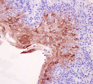 Immunohistochemistry (Formalin/PFA-fixed paraffin-embedded sections) - Anti-Involucrin antibody [EPR13054] (AB181980), expandable thumbnail