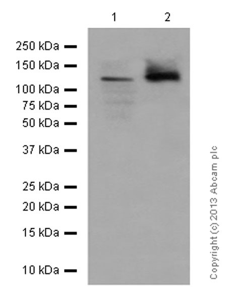 Western blot - Anti-Involucrin antibody [EPR13054] (AB181980), expandable thumbnail