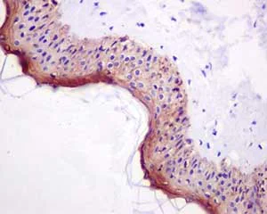 Immunohistochemistry (Formalin/PFA-fixed paraffin-embedded sections) - Anti-Involucrin antibody [EPR13054] - BSA and Azide free (AB240256)