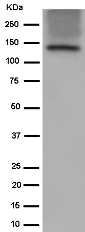 Western blot - Anti-Involucrin antibody [EPR13060(N)] - C-terminal (AB184969)