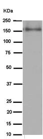 Western blot - Anti-Involucrin antibody [EPR13060(N)] - C-terminal (AB184969)