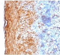 Immunohistochemistry (Formalin/PFA-fixed paraffin-embedded sections) - Anti-Involucrin antibody [IVRN/2113R] (AB234403), expandable thumbnail