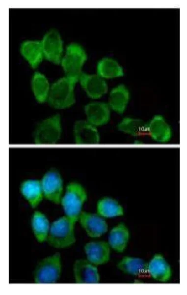 Immunocytochemistry/ Immunofluorescence - Anti-Involucrin antibody - N-terminal (AB227530)